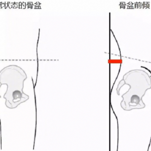 Q38水+40月临汾-任女士：肩膀怕凉眼干