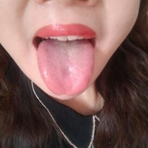 Q40水新疆张女士：屁股和腰经常觉得冷